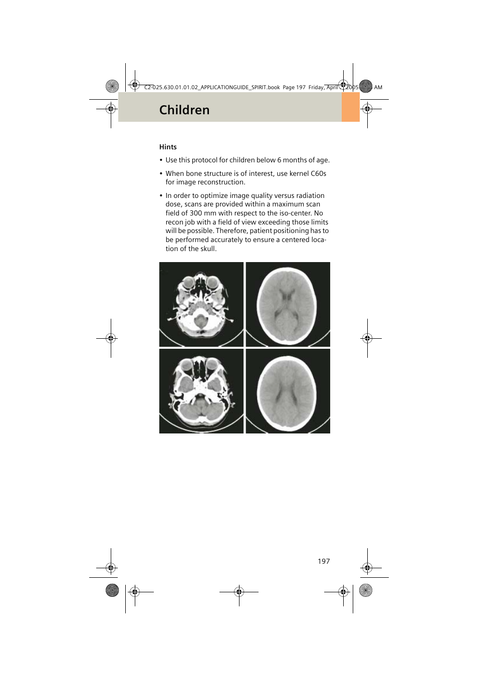 Children | Siemens syngo CT 2005C User Manual | Page 197 / 321