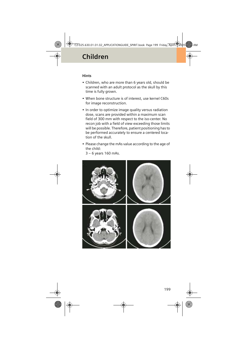 Children | Siemens syngo CT 2005C User Manual | Page 199 / 321