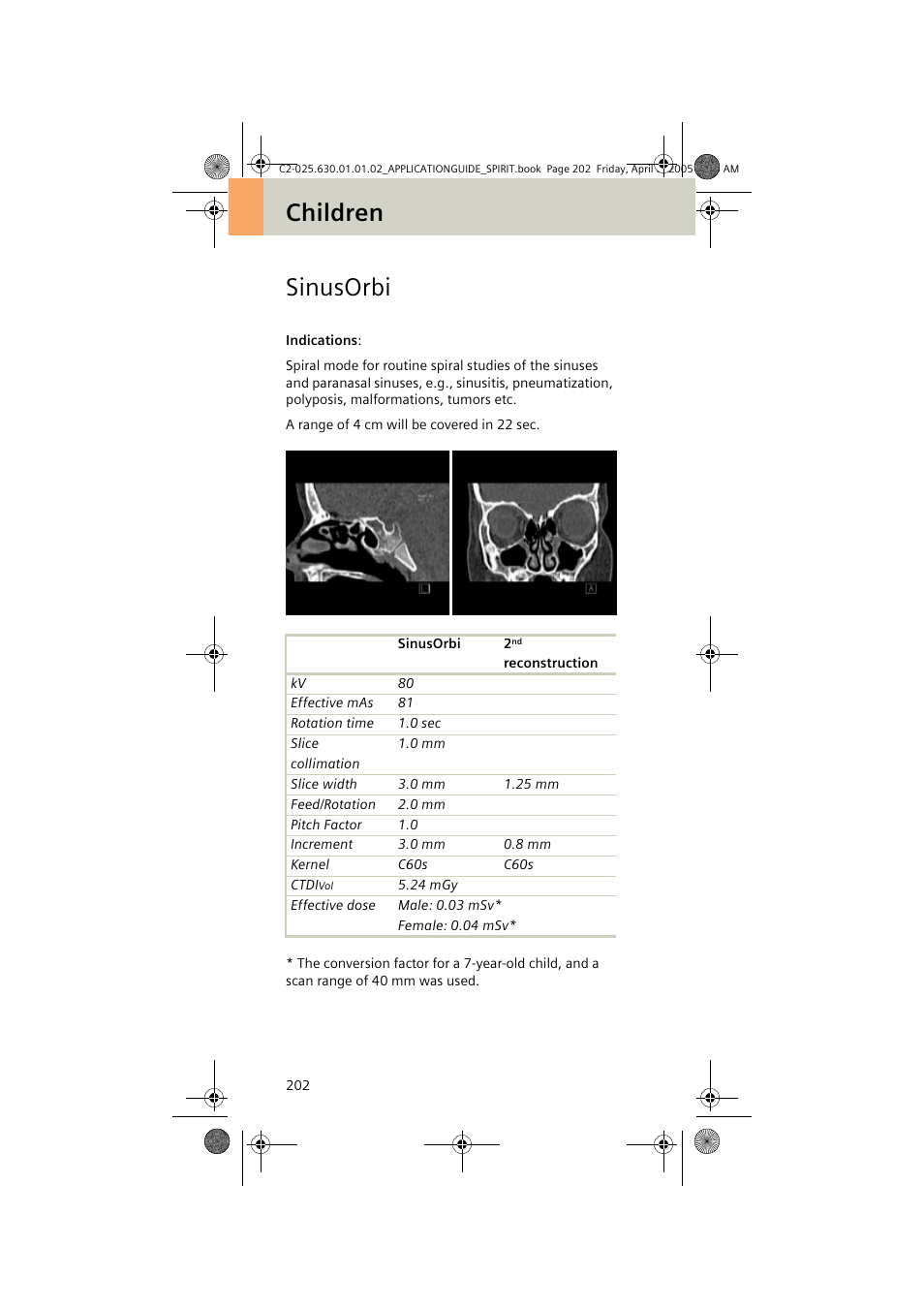 Sinusorbi, Children sinusorbi | Siemens syngo CT 2005C User Manual | Page 202 / 321