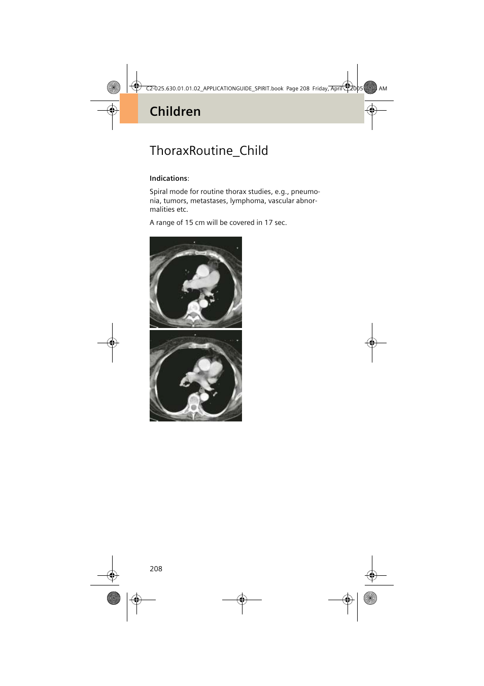 Thoraxroutine_child, Children thoraxroutine_child | Siemens syngo CT 2005C User Manual | Page 208 / 321