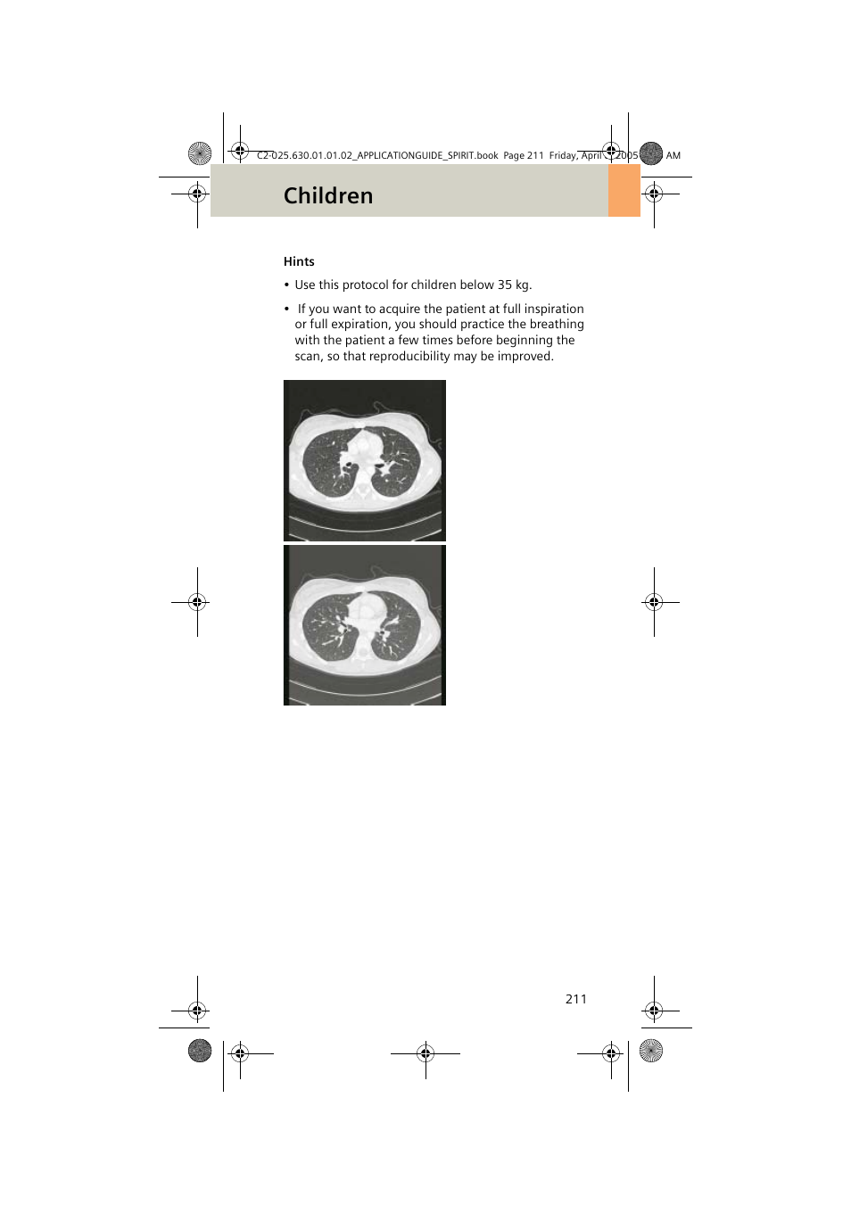 Children | Siemens syngo CT 2005C User Manual | Page 211 / 321
