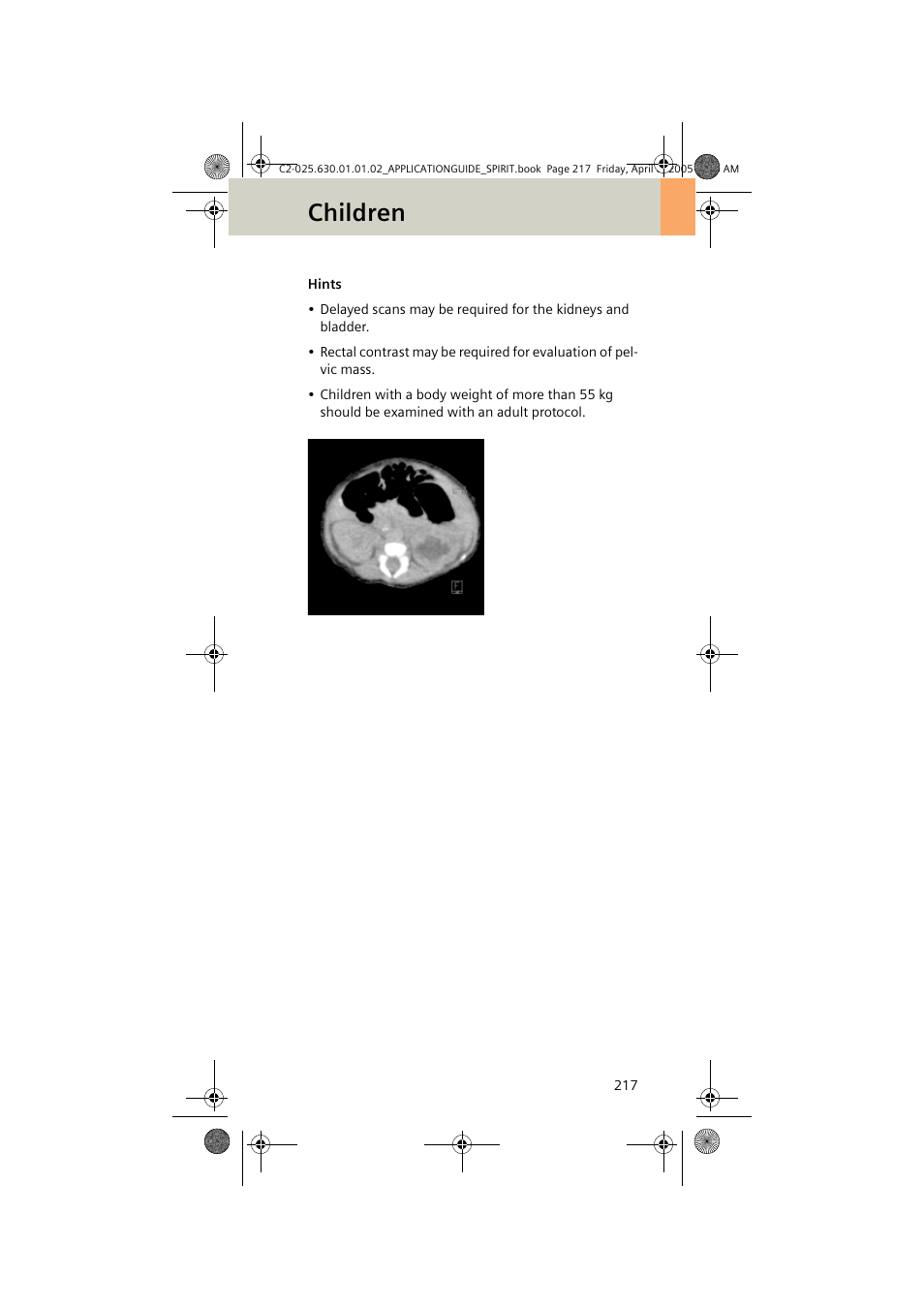 Children | Siemens syngo CT 2005C User Manual | Page 217 / 321