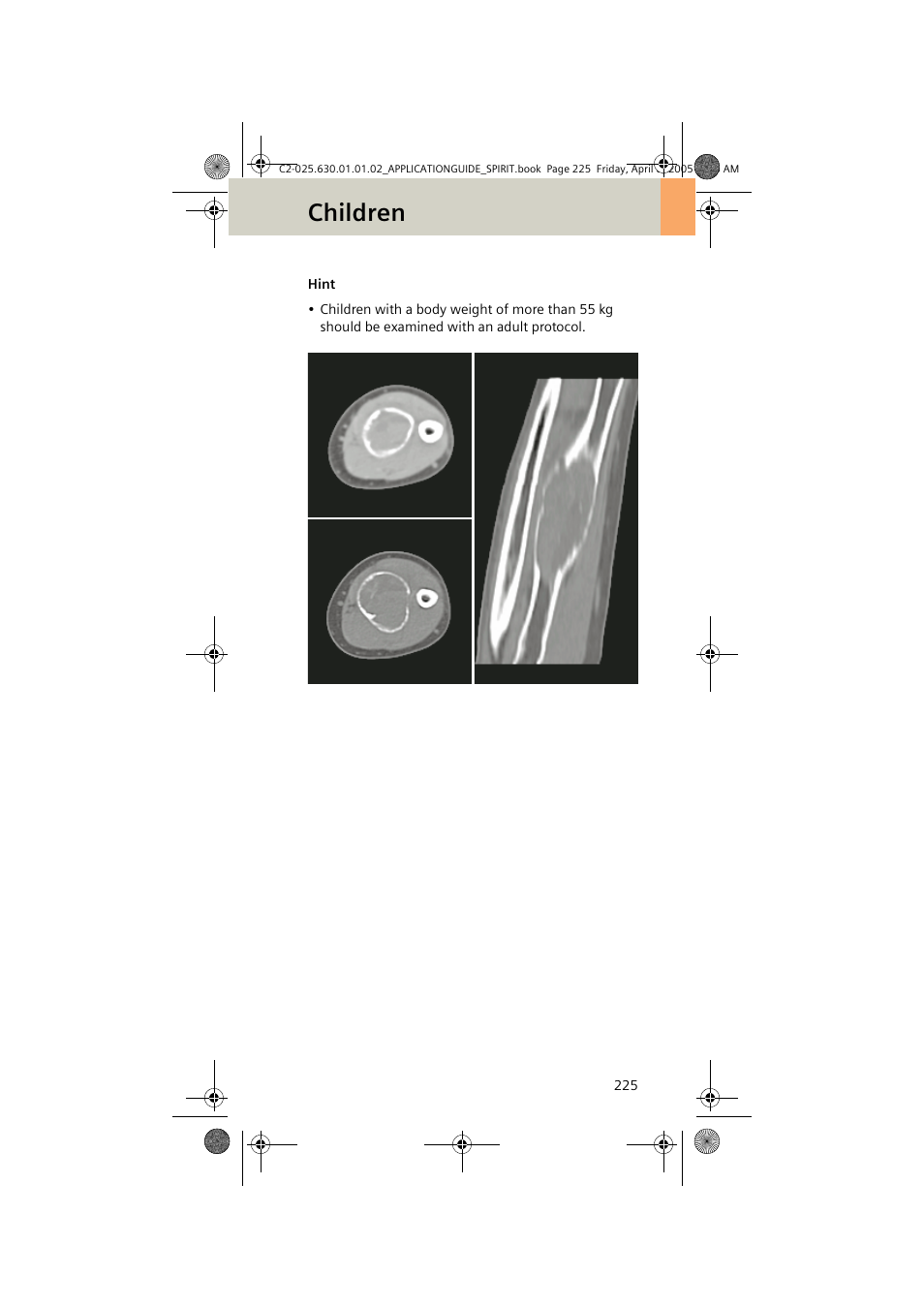 Children | Siemens syngo CT 2005C User Manual | Page 225 / 321