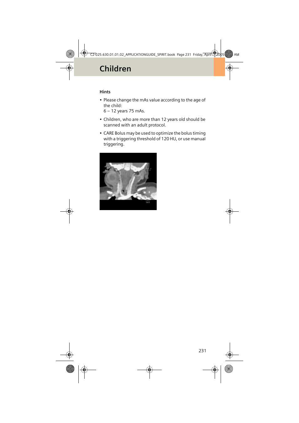 Children | Siemens syngo CT 2005C User Manual | Page 231 / 321