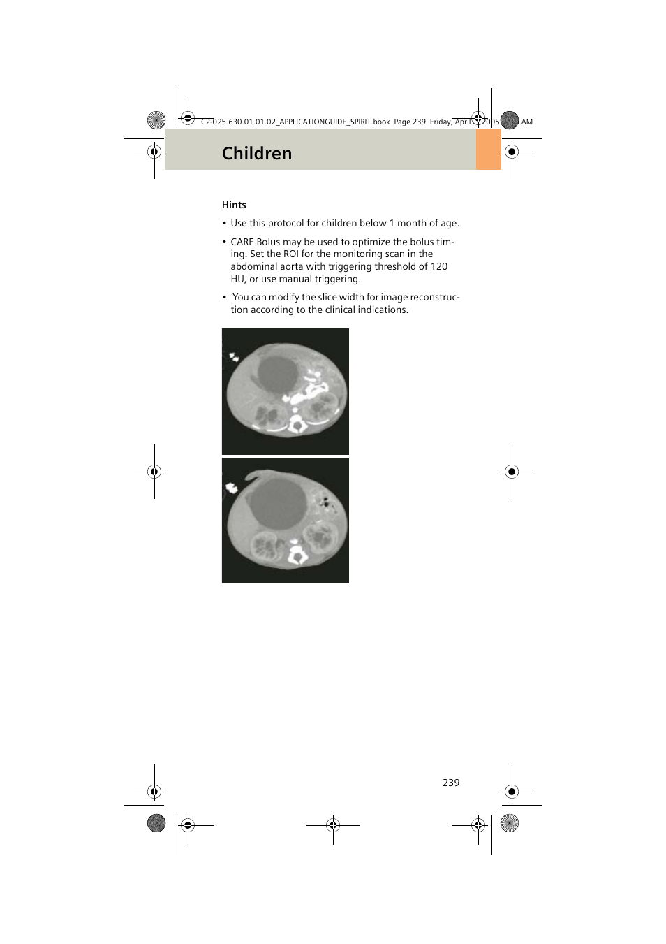 Children | Siemens syngo CT 2005C User Manual | Page 239 / 321