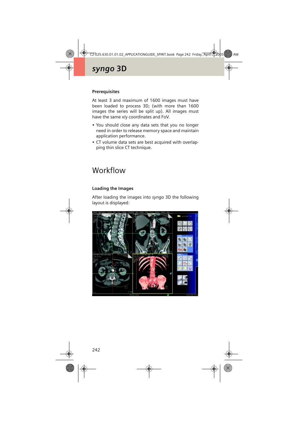 Prerequisites, Workflow, Loading the images | Prerequisites 242, Syngo 3d | Siemens syngo CT 2005C User Manual | Page 242 / 321