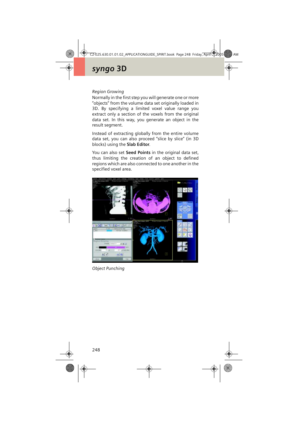 Syngo 3d | Siemens syngo CT 2005C User Manual | Page 248 / 321