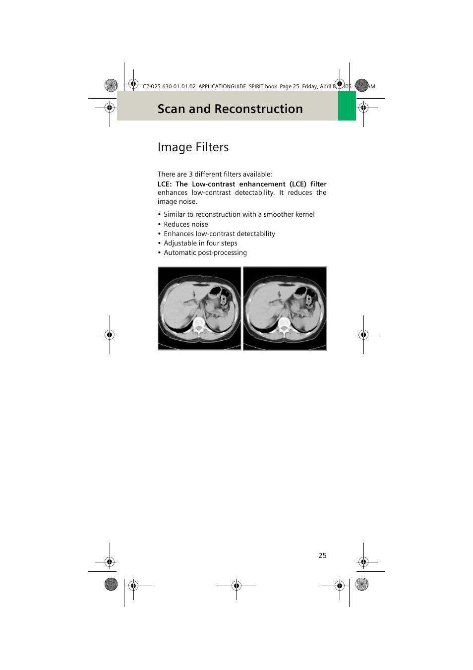 Image filters, Scan and reconstruction | Siemens syngo CT 2005C User Manual | Page 25 / 321