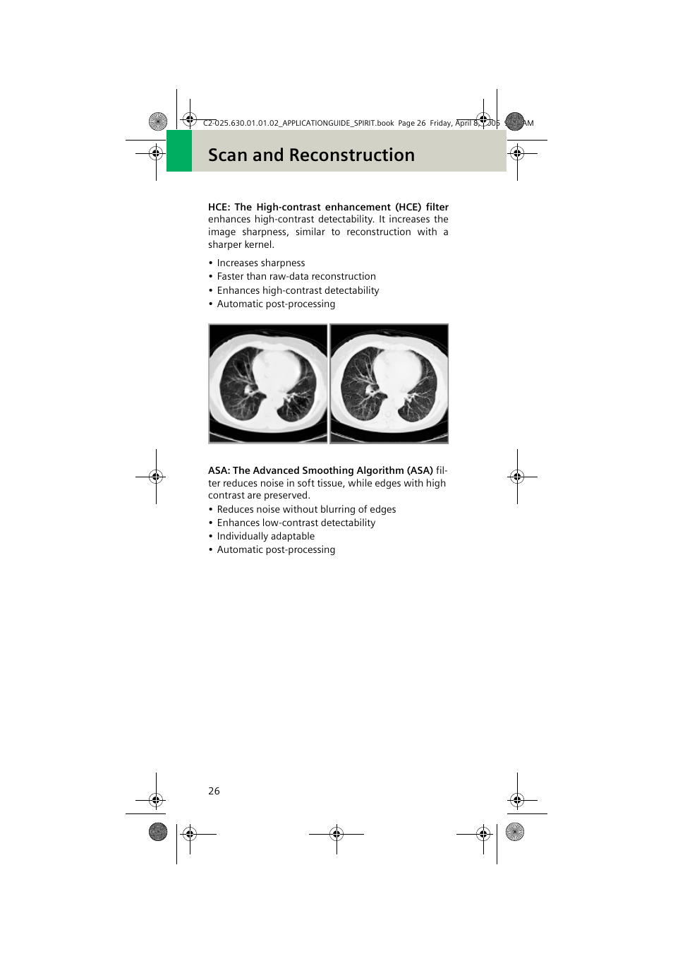 Scan and reconstruction | Siemens syngo CT 2005C User Manual | Page 26 / 321