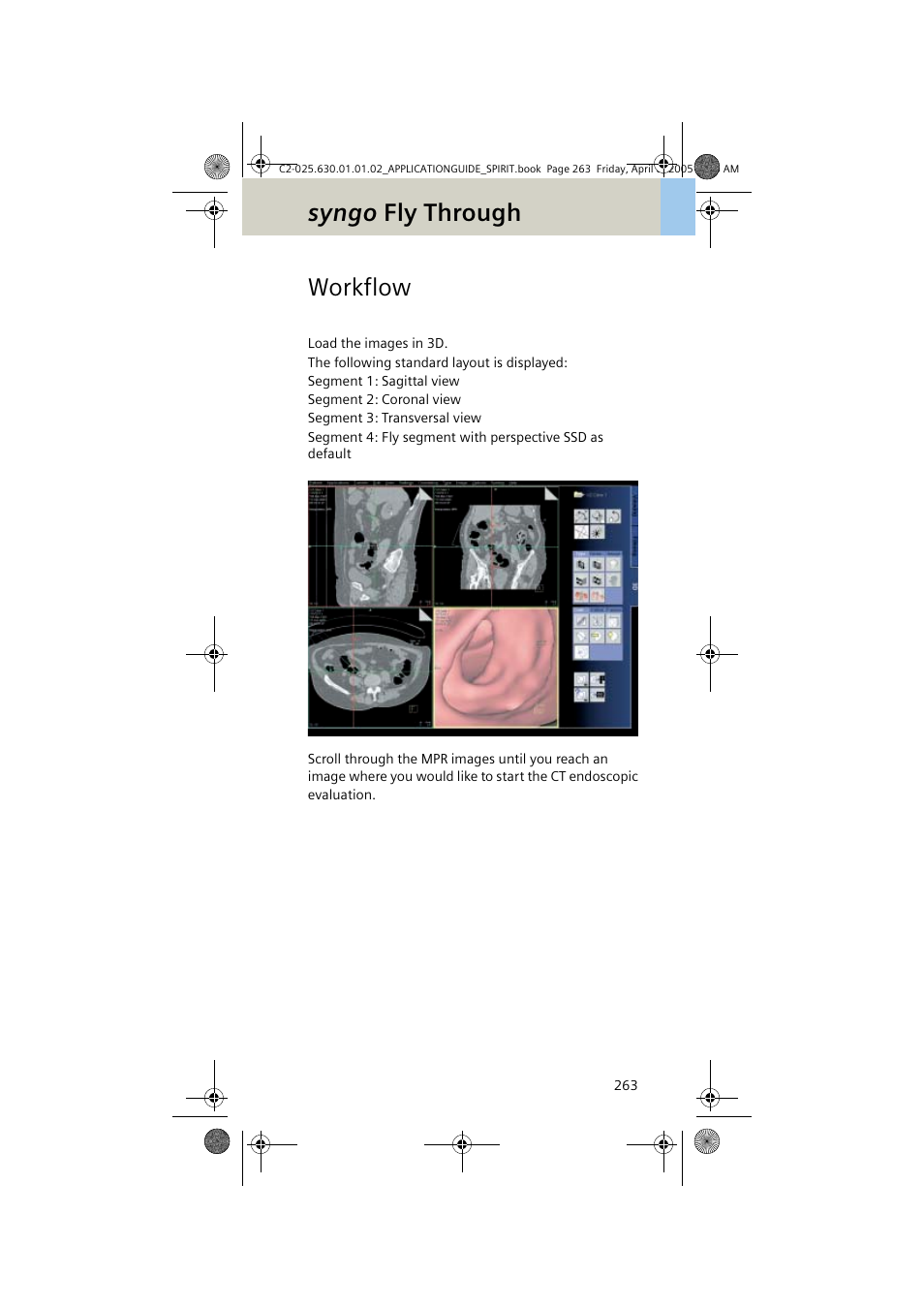 Workflow, Syngo fly through | Siemens syngo CT 2005C User Manual | Page 263 / 321