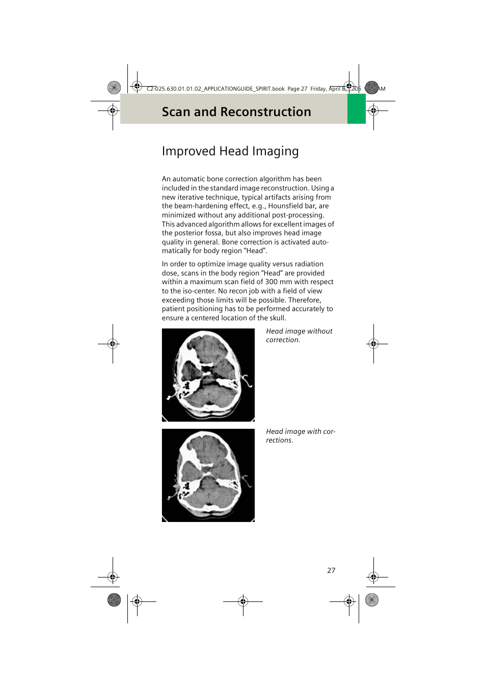 Improved head imaging, Scan and reconstruction | Siemens syngo CT 2005C User Manual | Page 27 / 321