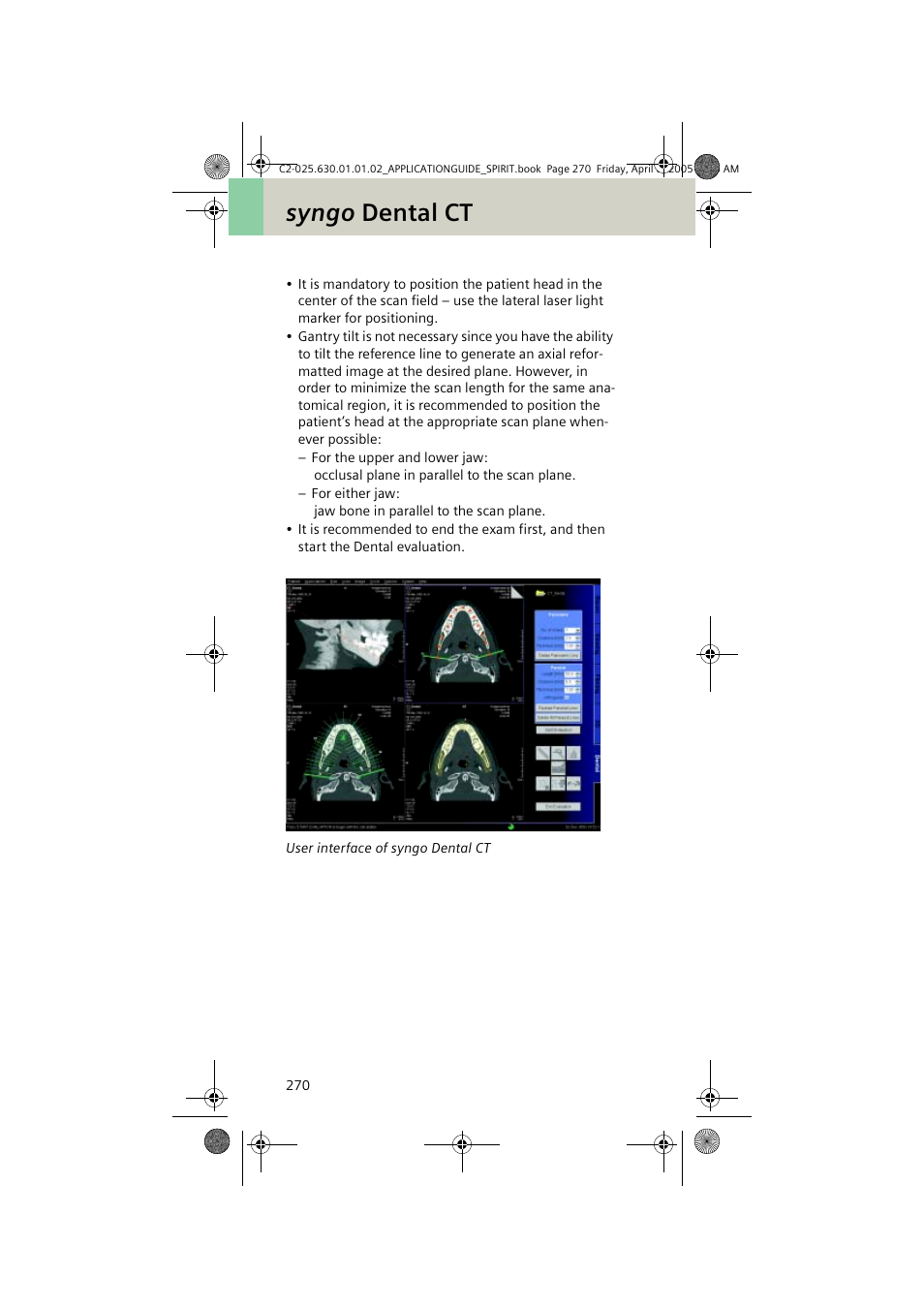 Syngo dental ct | Siemens syngo CT 2005C User Manual | Page 270 / 321