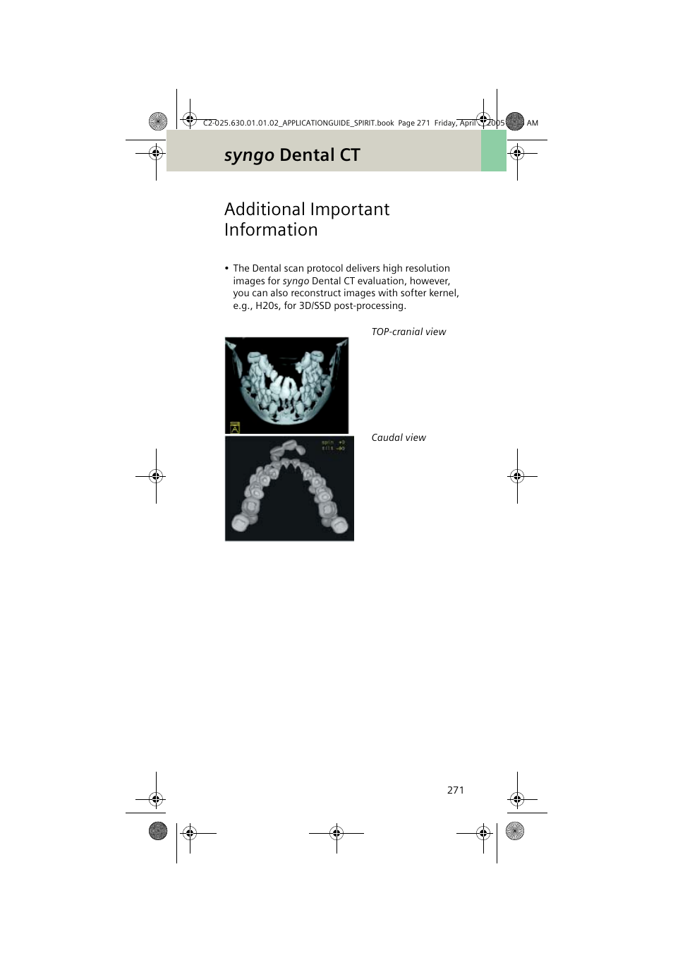 Additional important information, Syngo dental ct | Siemens syngo CT 2005C User Manual | Page 271 / 321