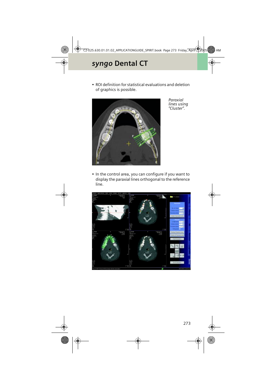 Syngo dental ct | Siemens syngo CT 2005C User Manual | Page 273 / 321