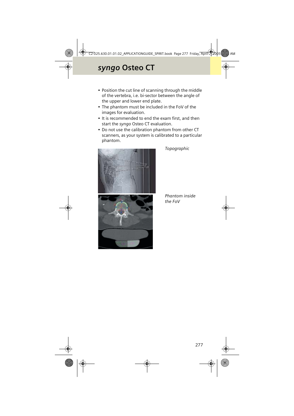 Syngo osteo ct | Siemens syngo CT 2005C User Manual | Page 277 / 321