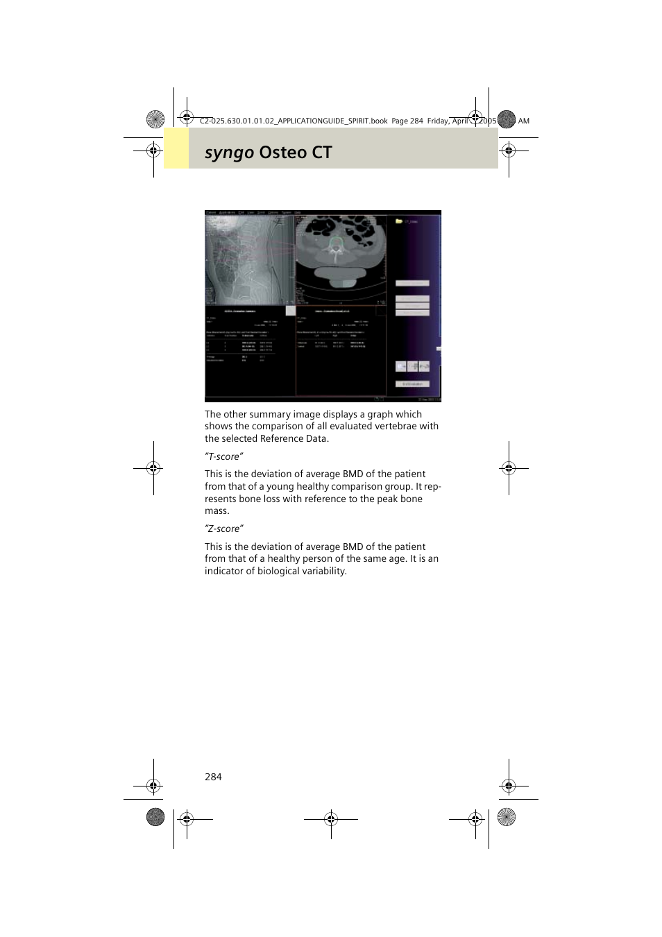 Syngo osteo ct | Siemens syngo CT 2005C User Manual | Page 284 / 321