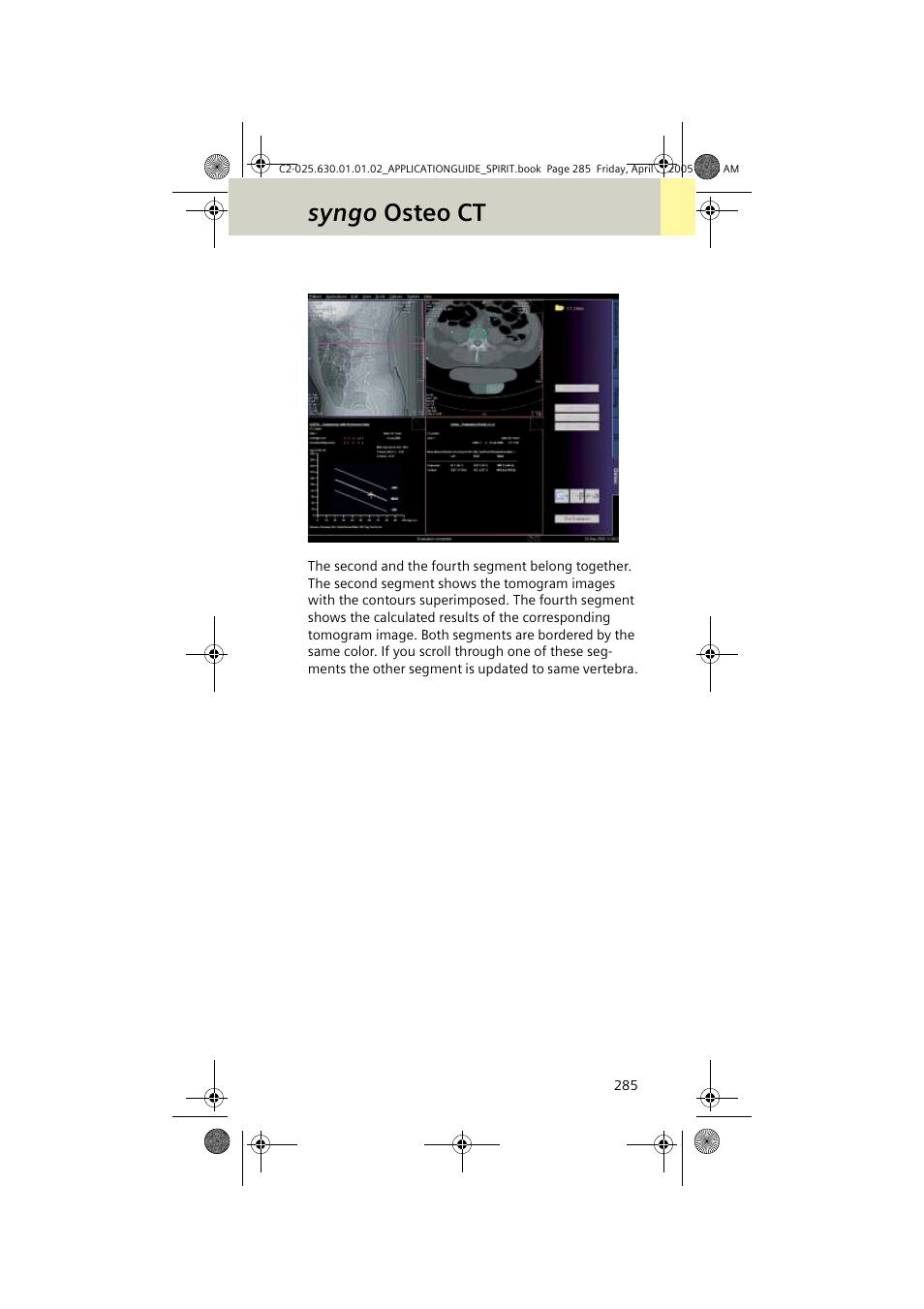 Syngo osteo ct | Siemens syngo CT 2005C User Manual | Page 285 / 321