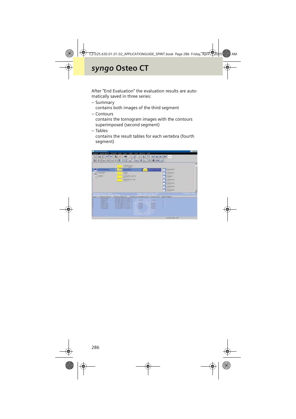 Syngo osteo ct | Siemens syngo CT 2005C User Manual | Page 286 / 321