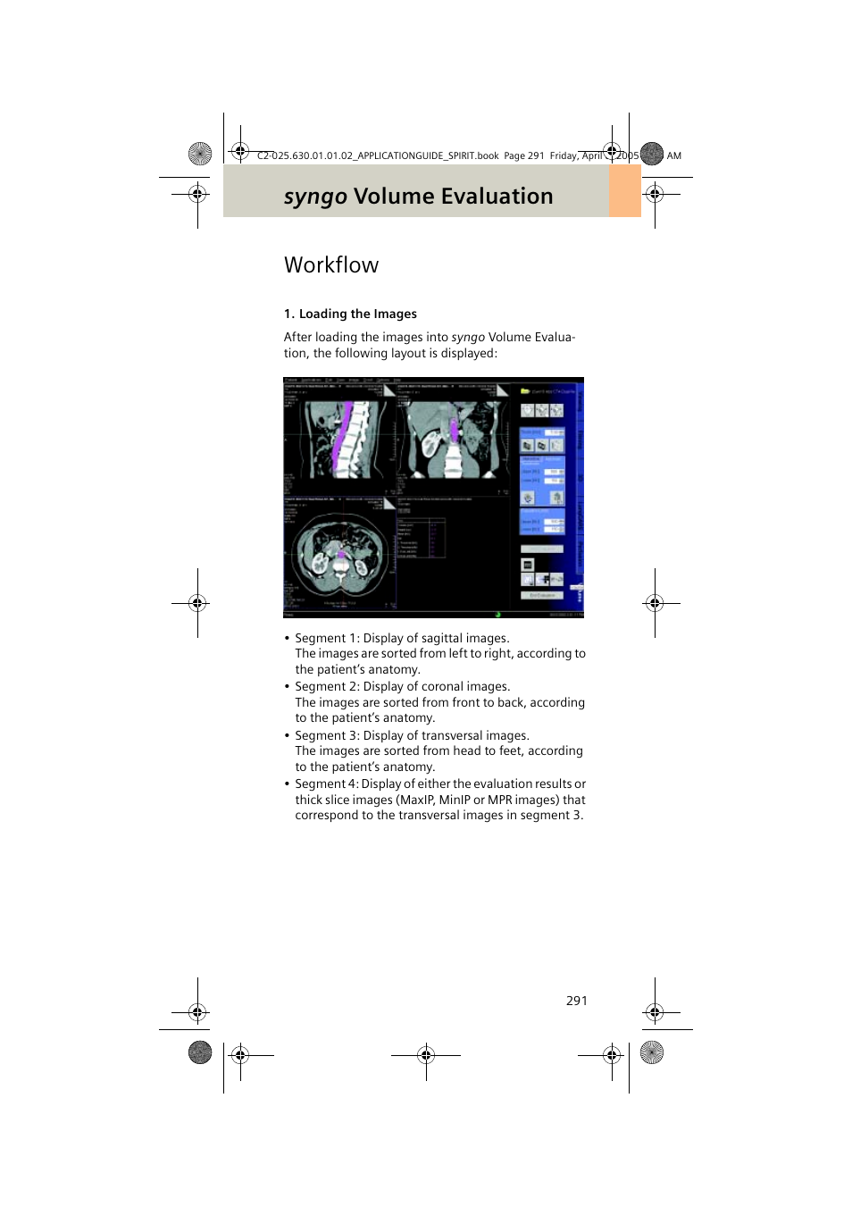 Workflow, Syngo volume evaluation | Siemens syngo CT 2005C User Manual | Page 291 / 321