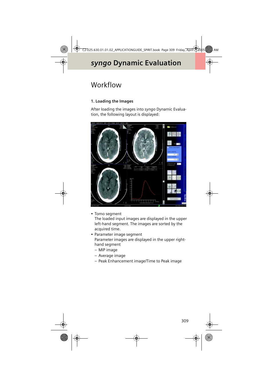 Workflow, Loading the images, Syngo dynamic evaluation | Siemens syngo CT 2005C User Manual | Page 309 / 321