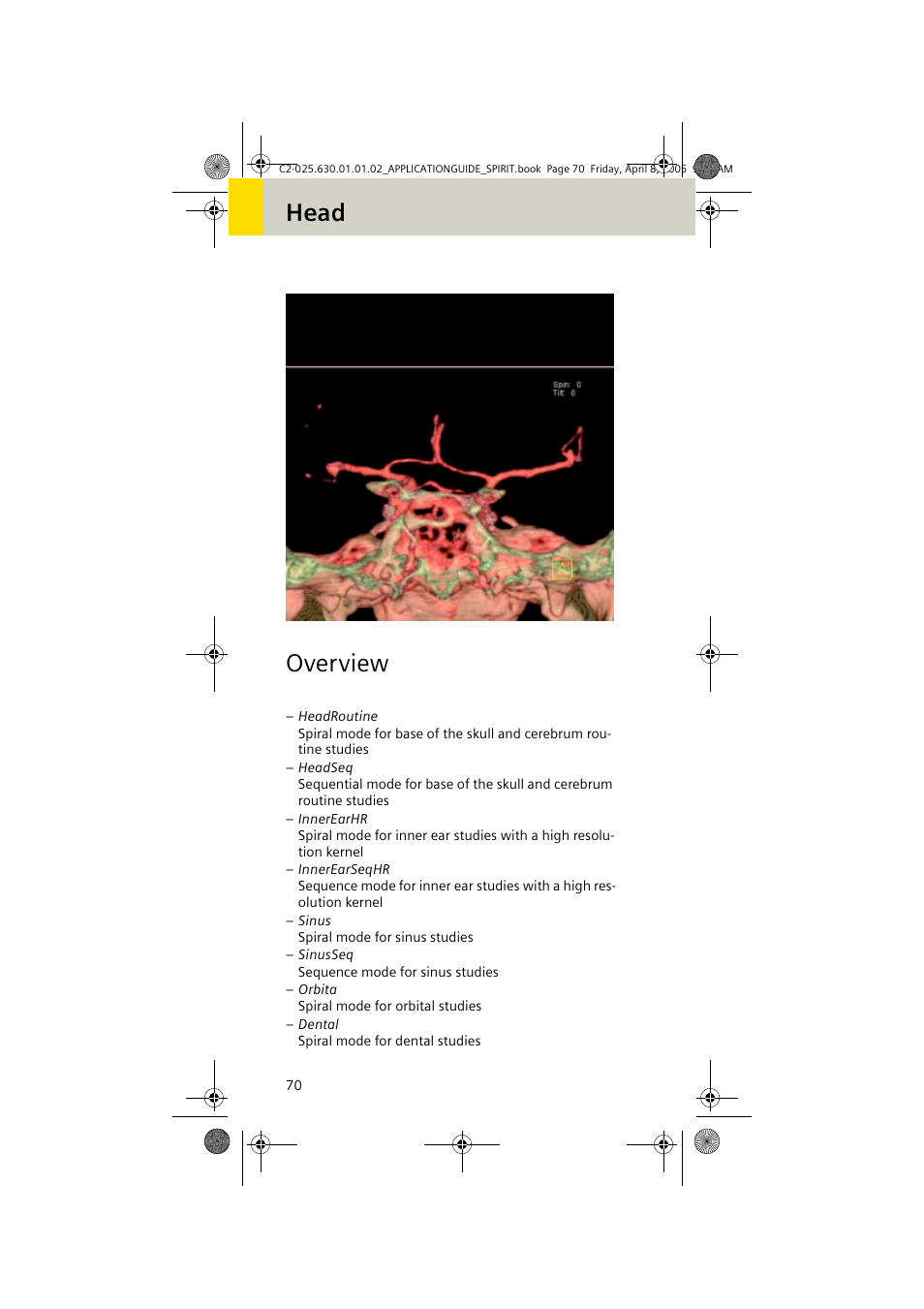 Head, Overview, Head overview | Siemens syngo CT 2005C User Manual | Page 70 / 321