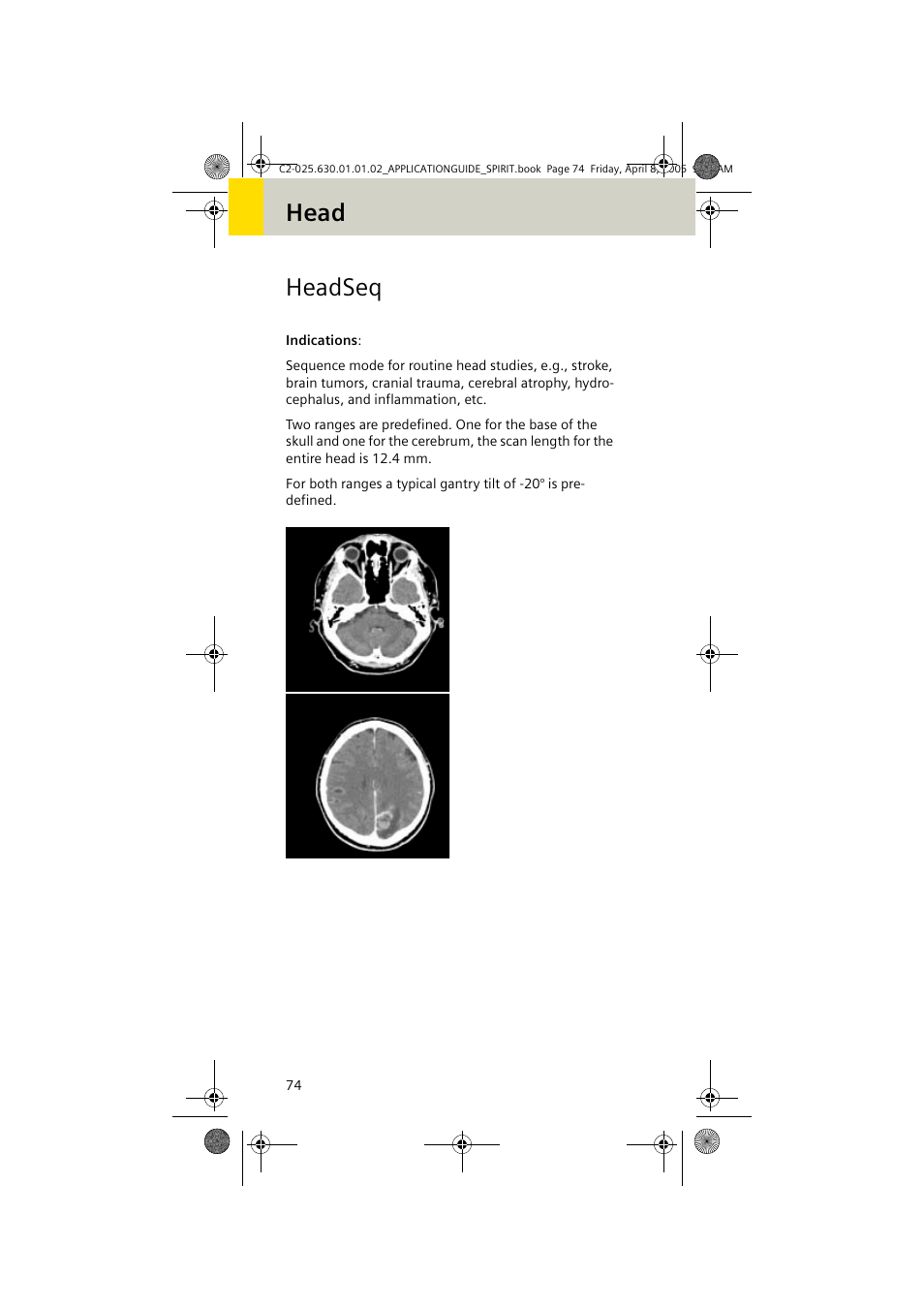 Headseq, Head headseq | Siemens syngo CT 2005C User Manual | Page 74 / 321