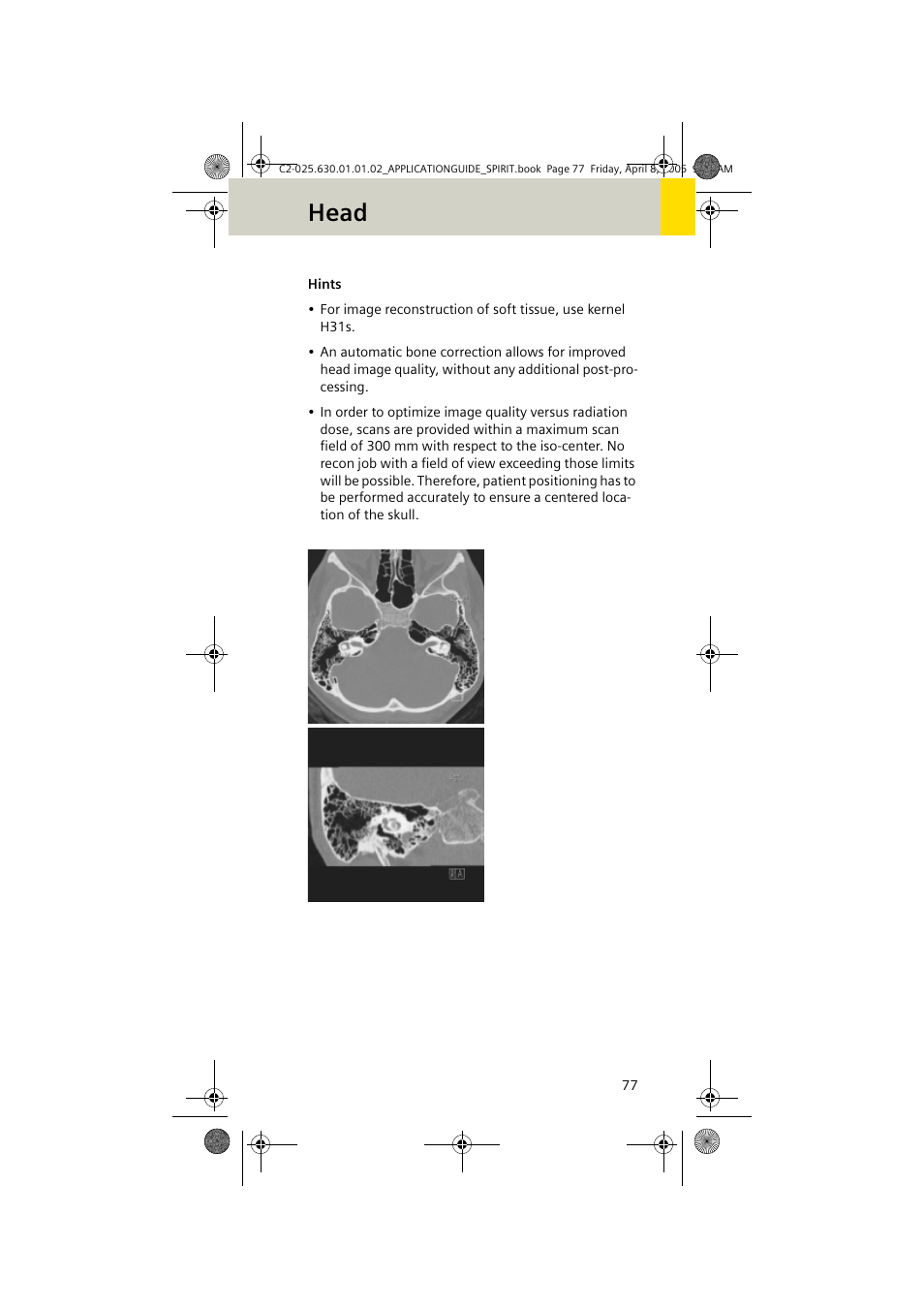 Head | Siemens syngo CT 2005C User Manual | Page 77 / 321