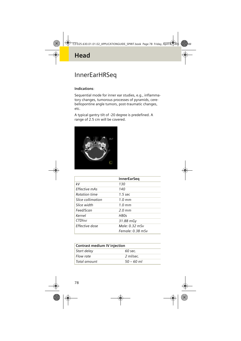 Innerearhrseq, Head innerearhrseq | Siemens syngo CT 2005C User Manual | Page 78 / 321