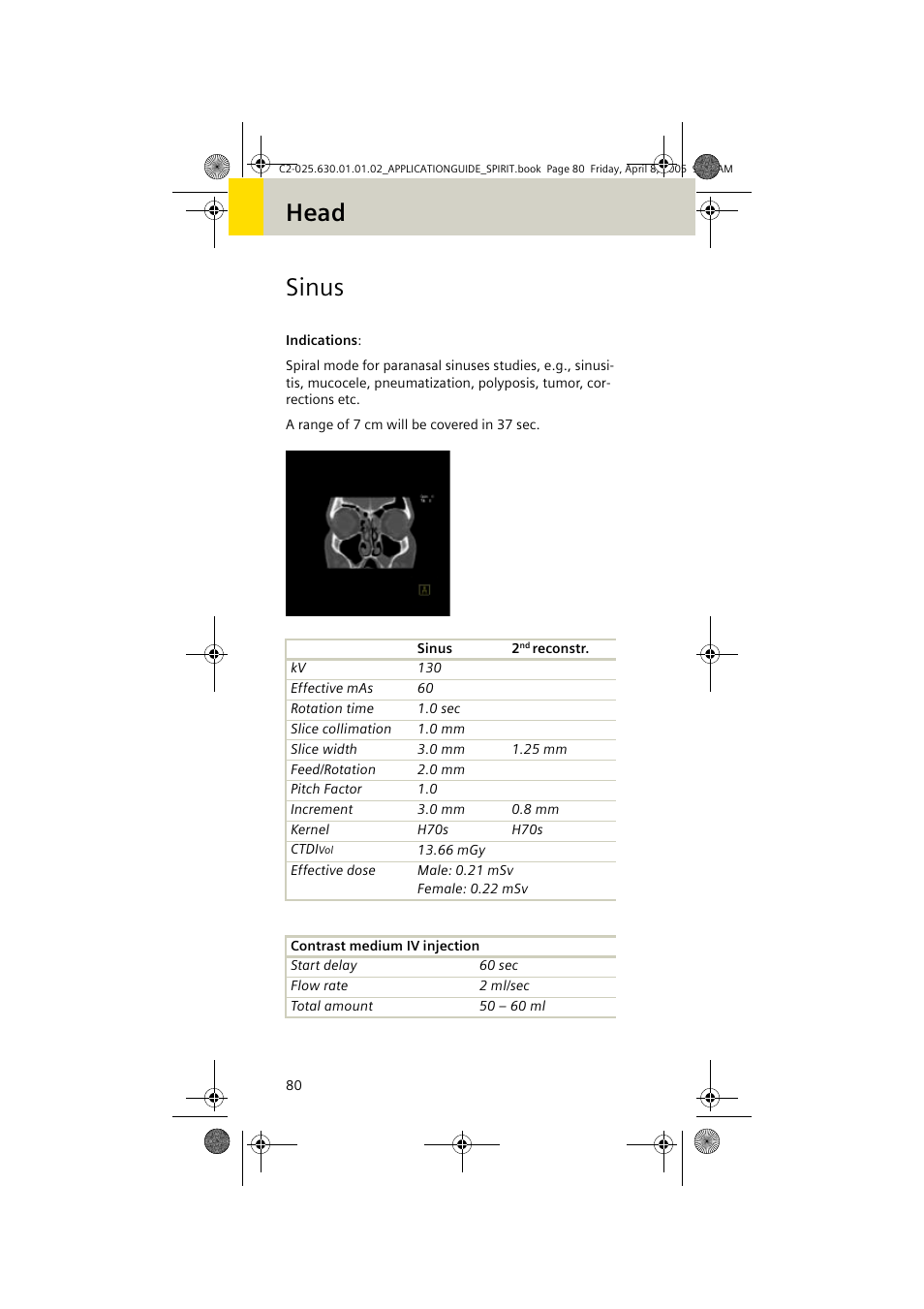 Sinus, Head sinus | Siemens syngo CT 2005C User Manual | Page 80 / 321