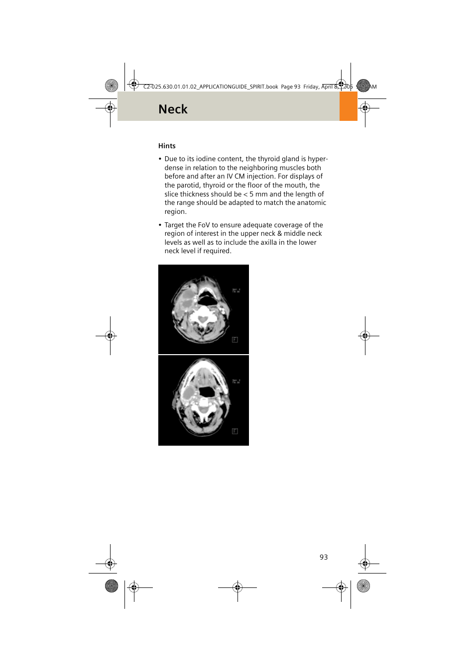 Neck | Siemens syngo CT 2005C User Manual | Page 93 / 321