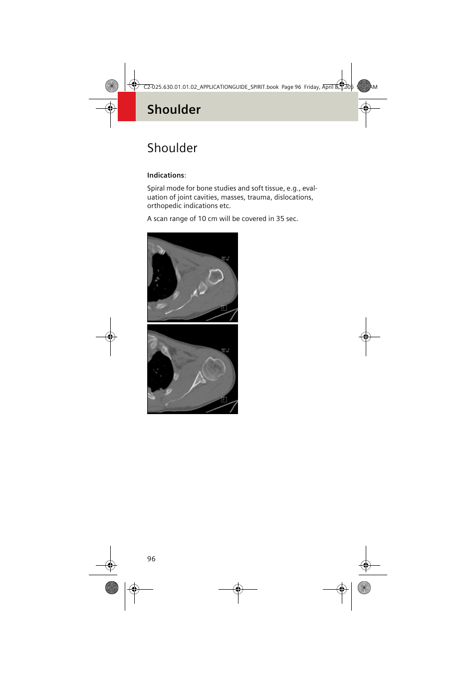 Shoulder | Siemens syngo CT 2005C User Manual | Page 96 / 321