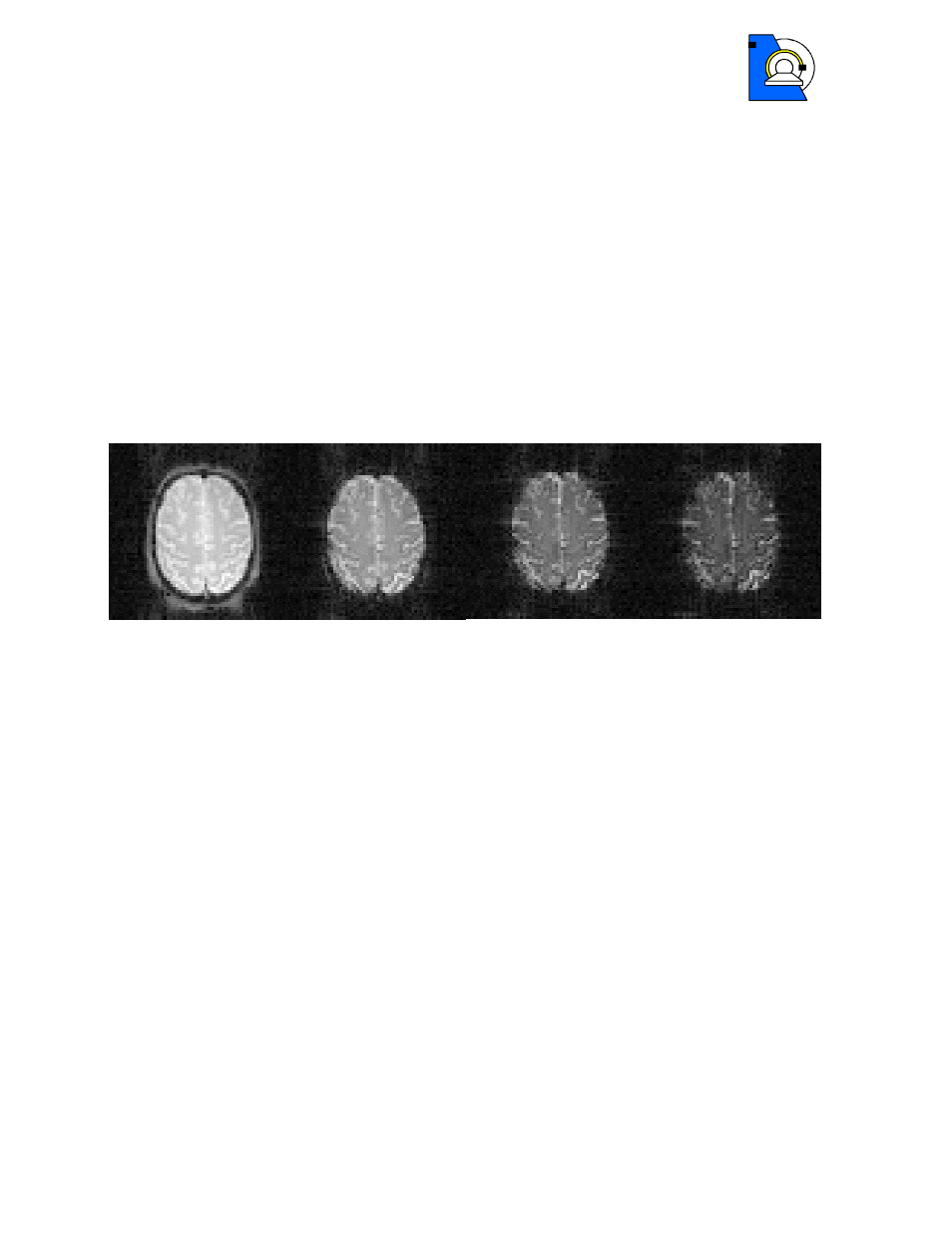 Image contrast of multi-echo epi, Processing options, References | 2 image contrast of multi-echo epi, 3 processing options, 4 references | Siemens MULTI-ECHO EPI 4A21 User Manual | Page 4 / 9