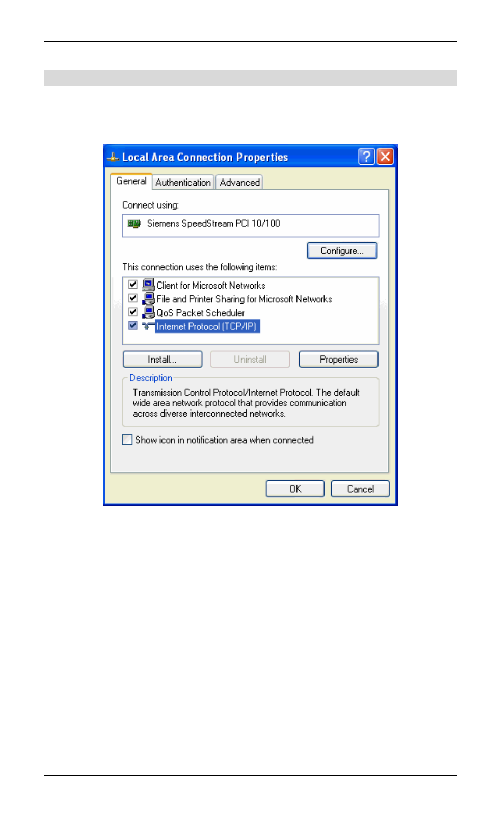 Checking tcp/ip settings - windows xp | Siemens SpeedStream SS2524 User Manual | Page 39 / 90