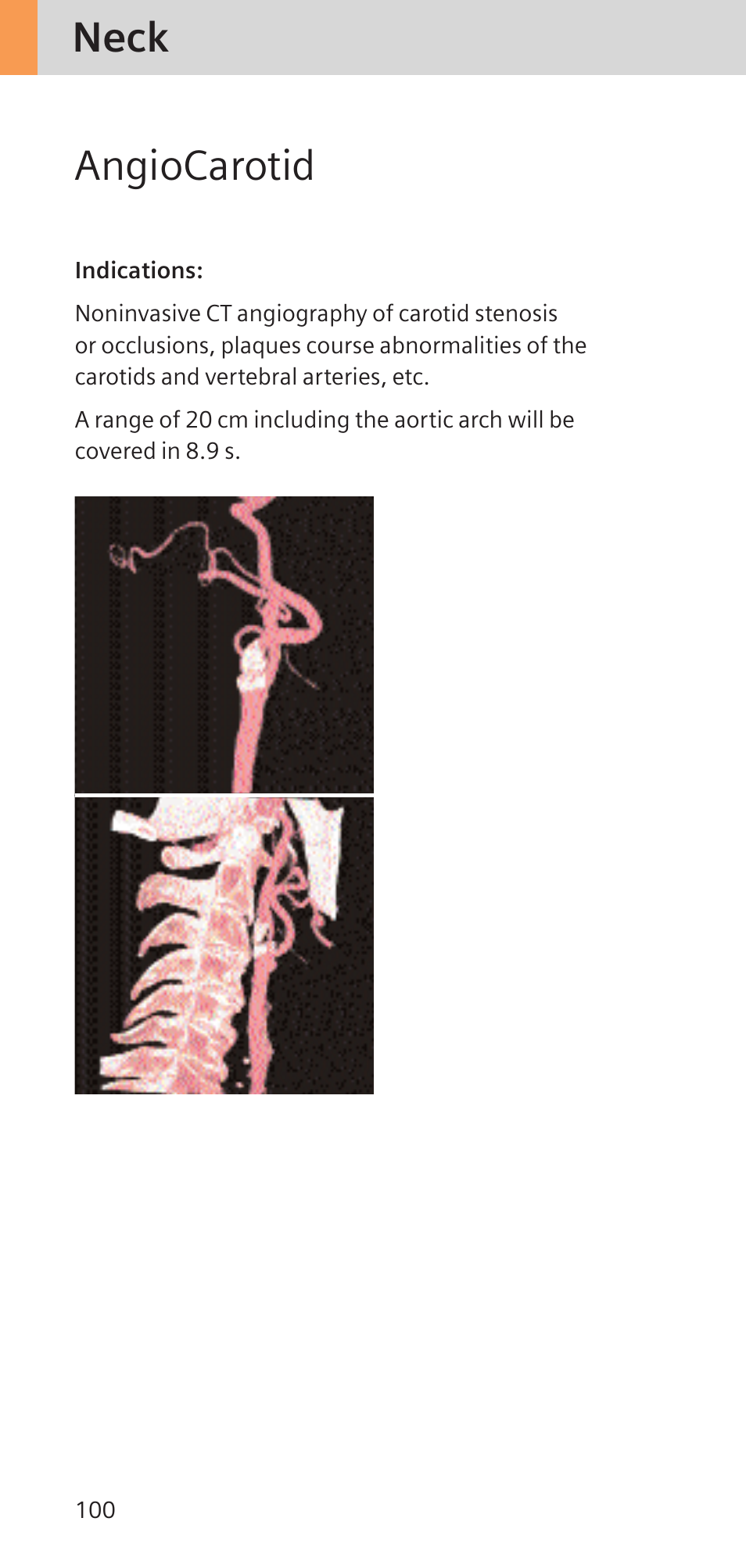 Neck angiocarotid | Siemens SOMATOM SENSATION CARDIAC A60 User Manual | Page 100 / 128