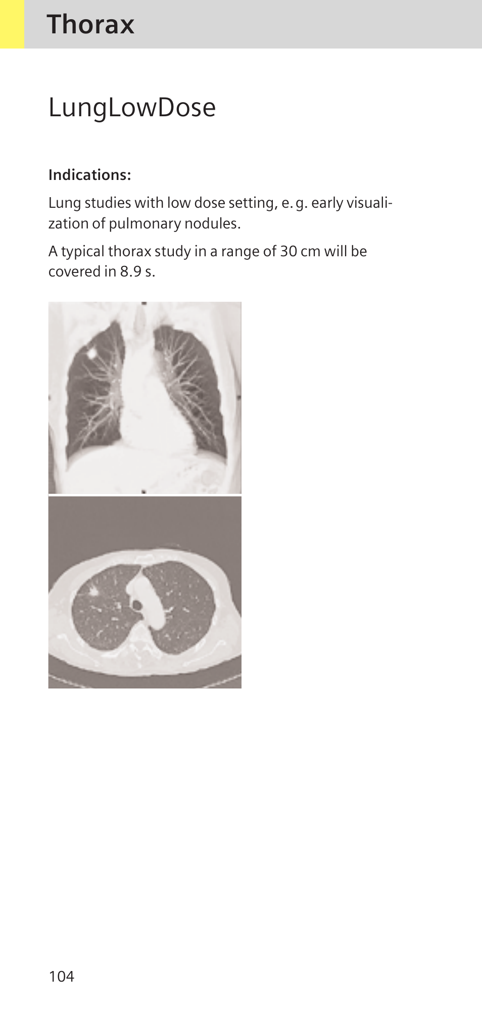 Lunglowdose, Thorax | Siemens SOMATOM SENSATION CARDIAC A60 User Manual | Page 104 / 128