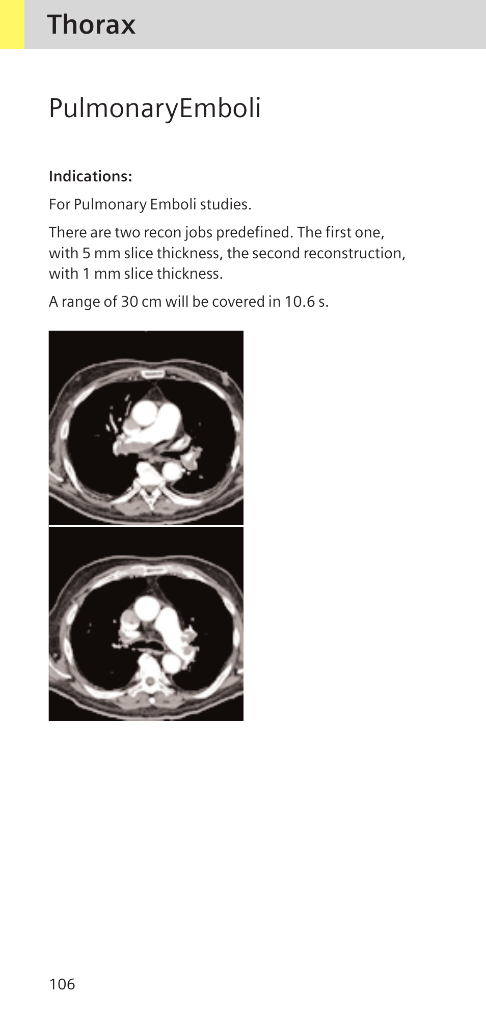 Pulmonaryemboli, Thorax | Siemens SOMATOM SENSATION CARDIAC A60 User Manual | Page 106 / 128