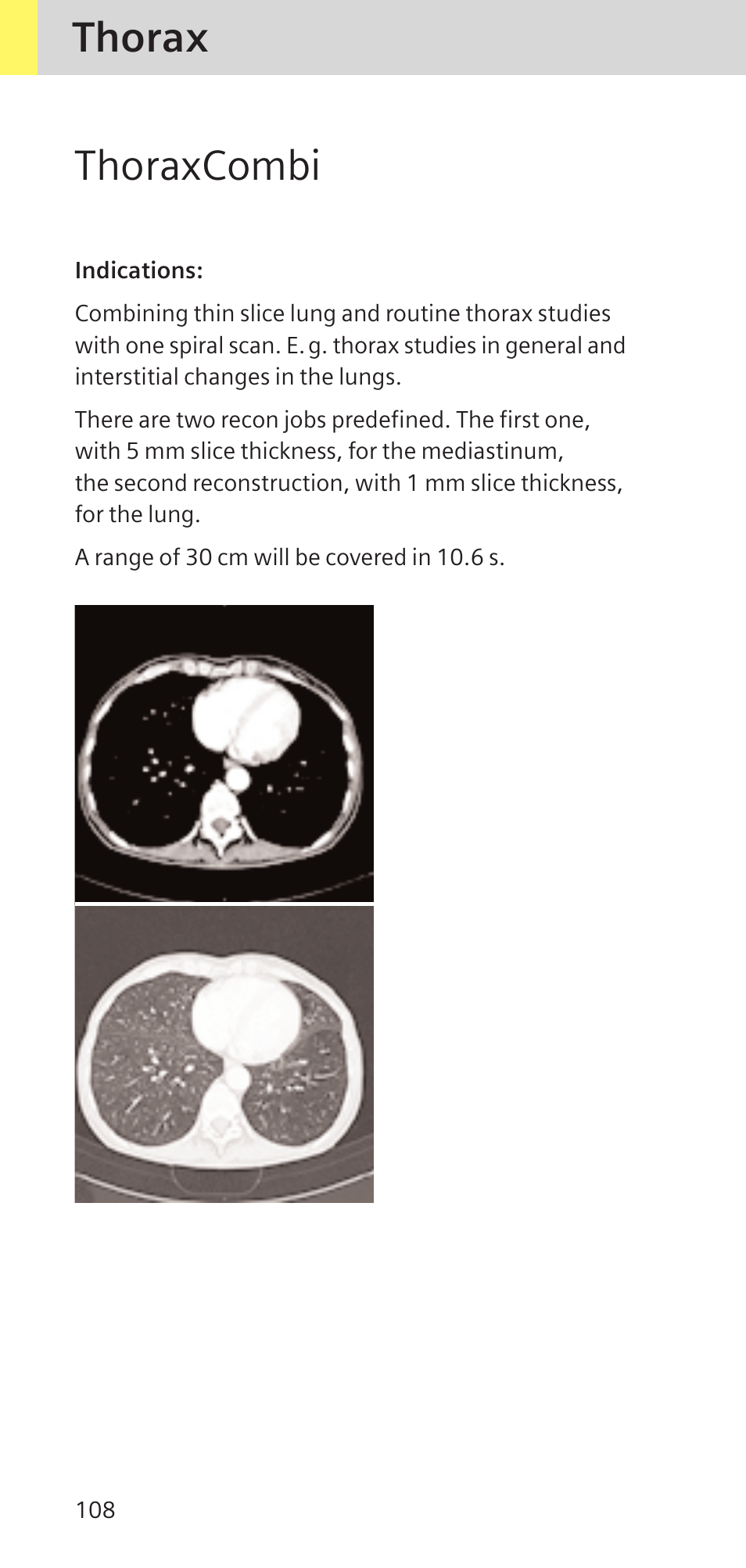 Thorax thoraxcombi | Siemens SOMATOM SENSATION CARDIAC A60 User Manual | Page 108 / 128
