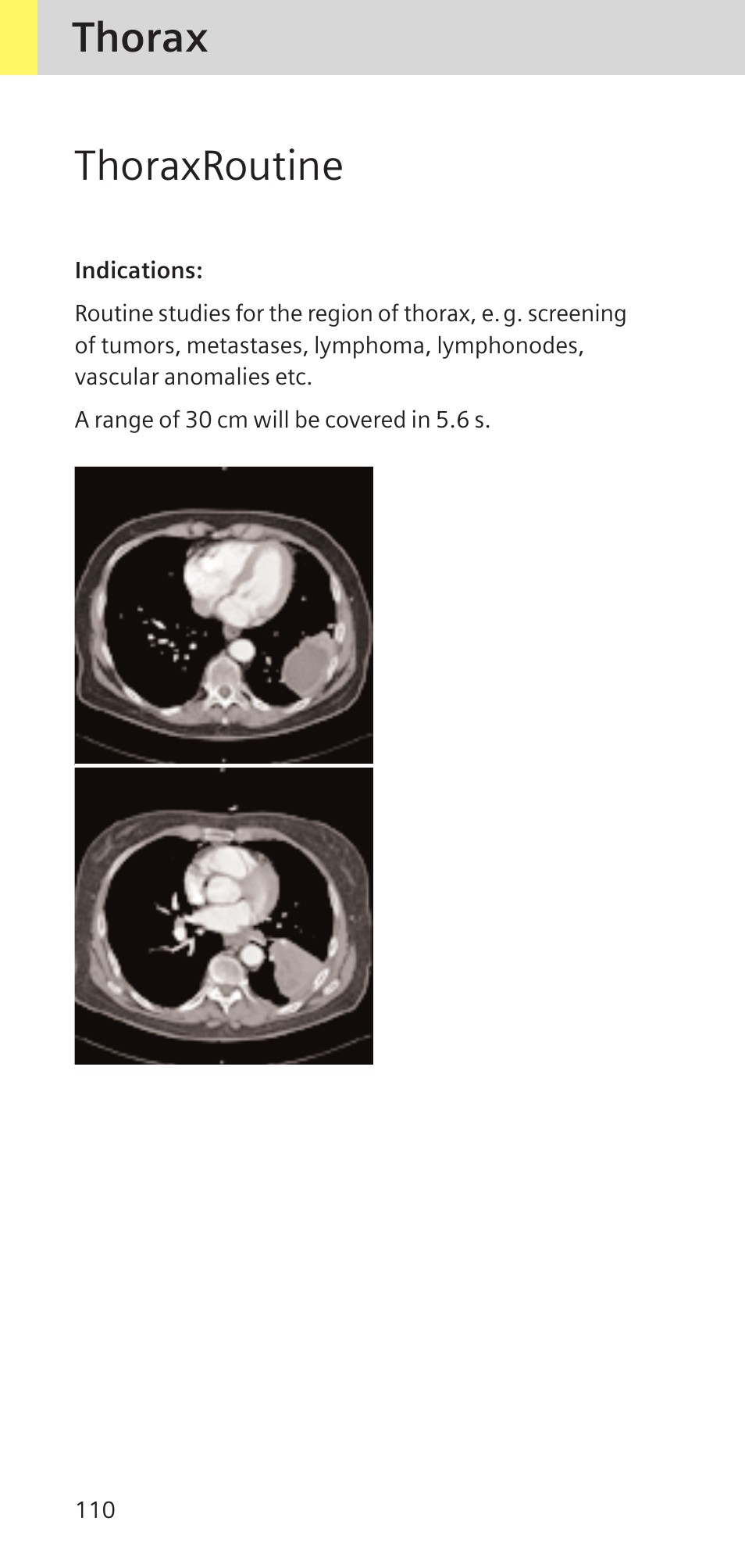 Thorax thoraxroutine | Siemens SOMATOM SENSATION CARDIAC A60 User Manual | Page 110 / 128