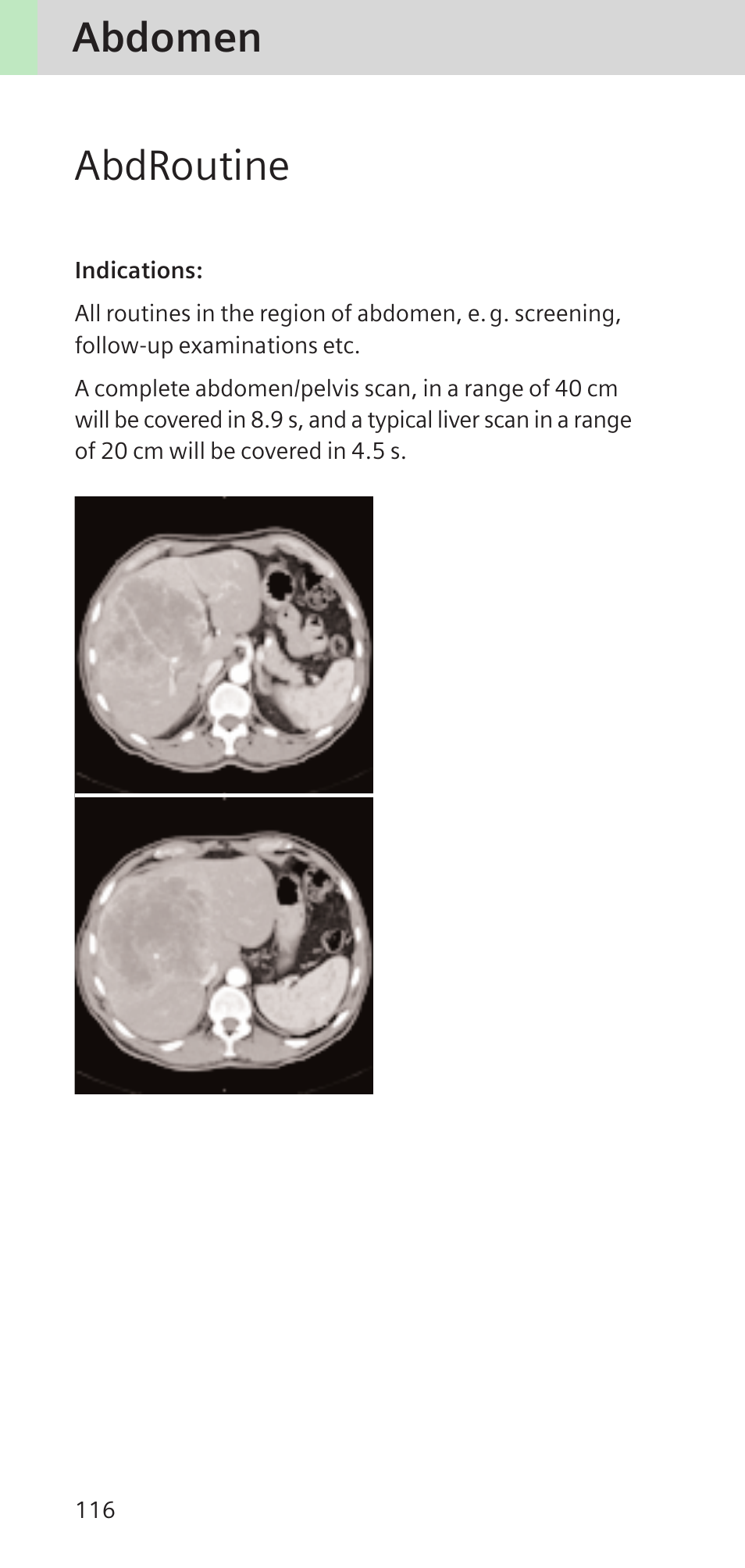 Abdomen abdroutine | Siemens SOMATOM SENSATION CARDIAC A60 User Manual | Page 116 / 128