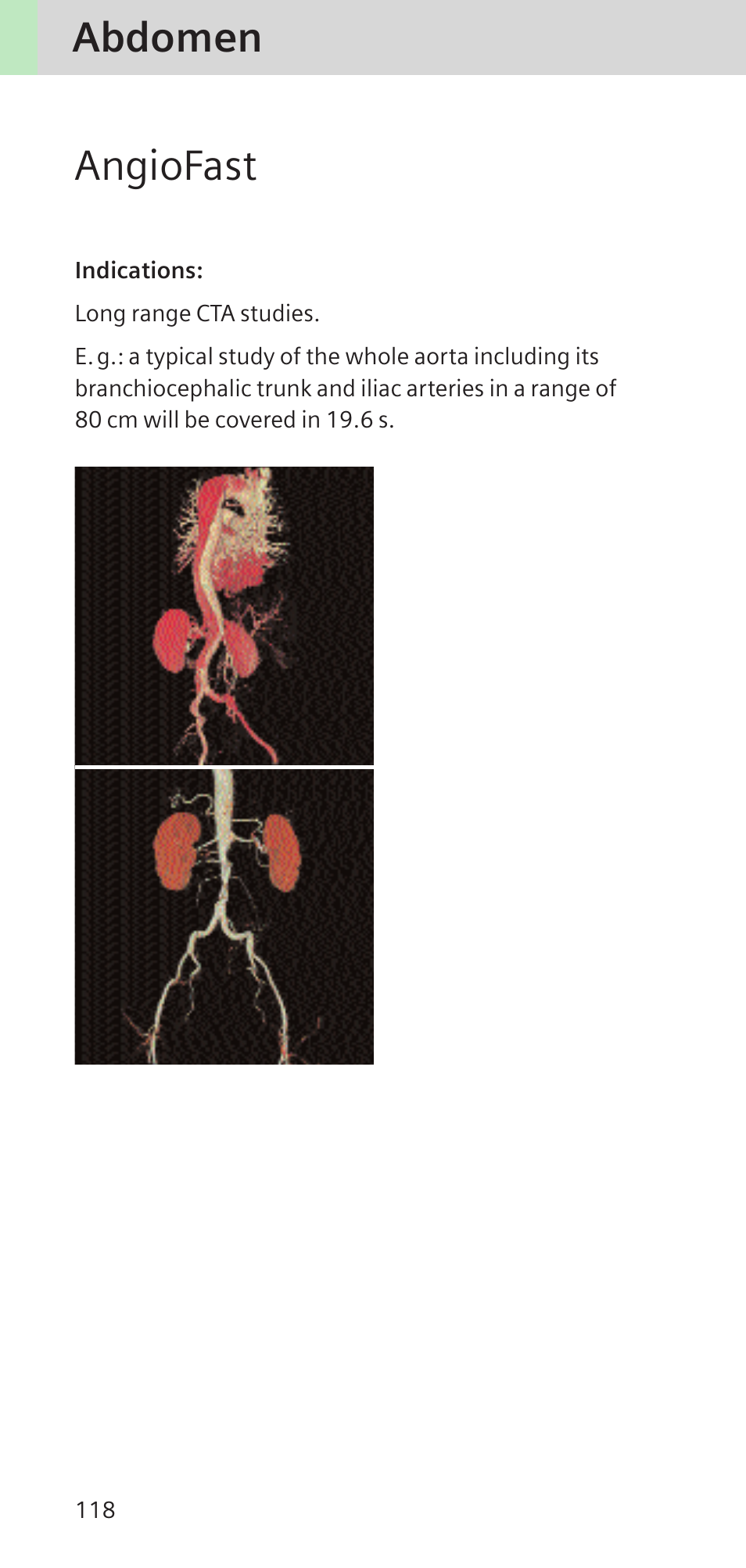 Angiofast, Abdomen | Siemens SOMATOM SENSATION CARDIAC A60 User Manual | Page 118 / 128