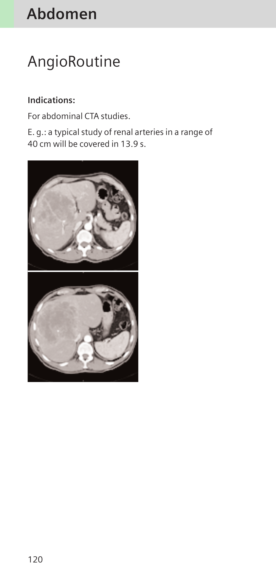 Angioroutine, Abdomen | Siemens SOMATOM SENSATION CARDIAC A60 User Manual | Page 120 / 128