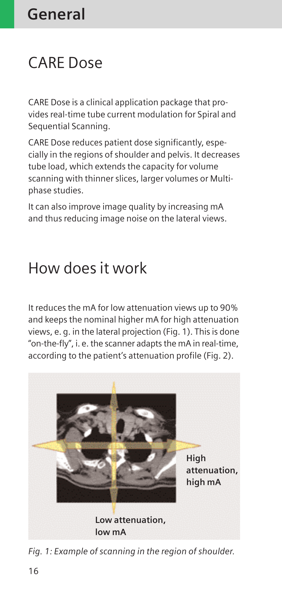General, Care dose, How does it work | Siemens SOMATOM SENSATION CARDIAC A60 User Manual | Page 16 / 128