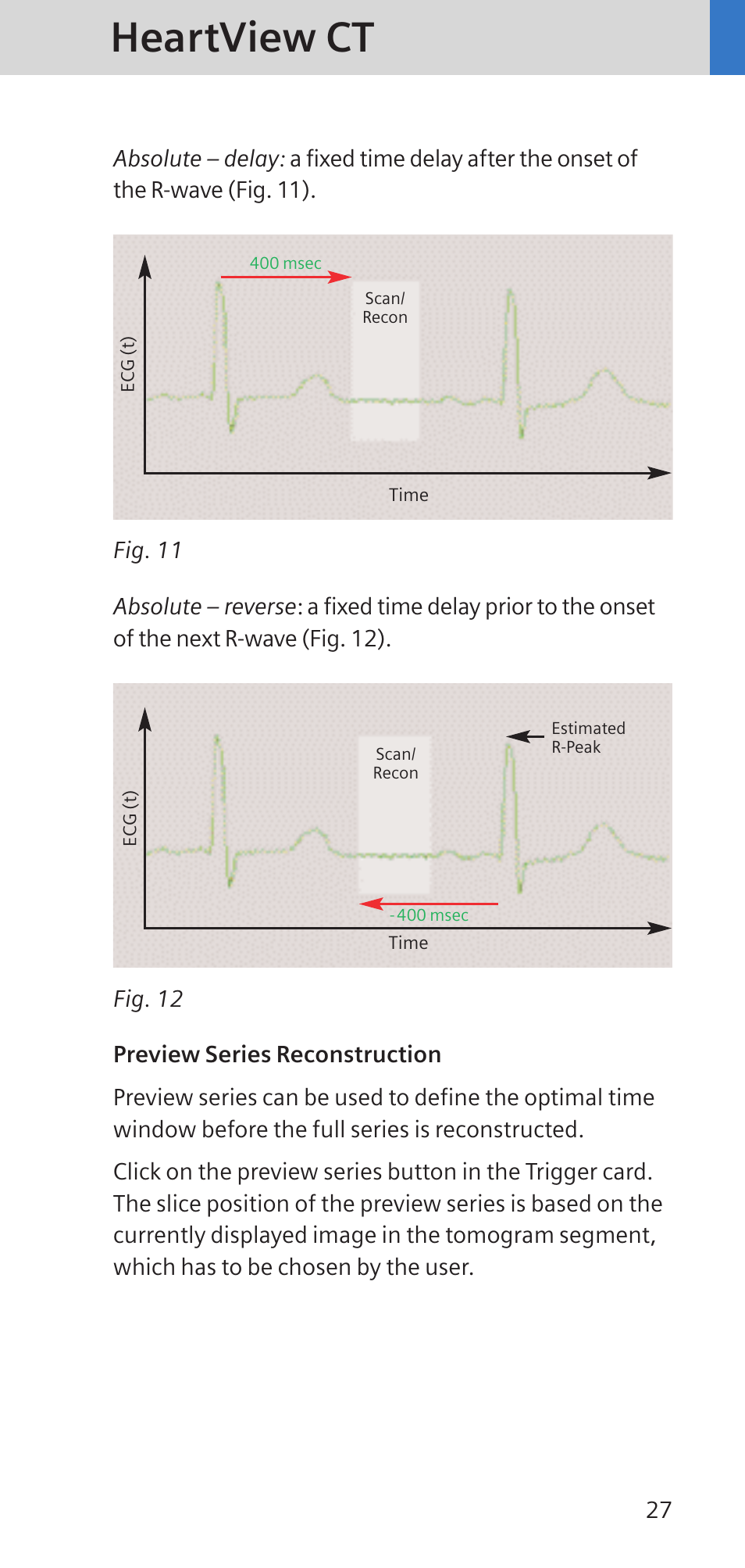 Heartview ct | Siemens SOMATOM SENSATION CARDIAC A60 User Manual | Page 27 / 128