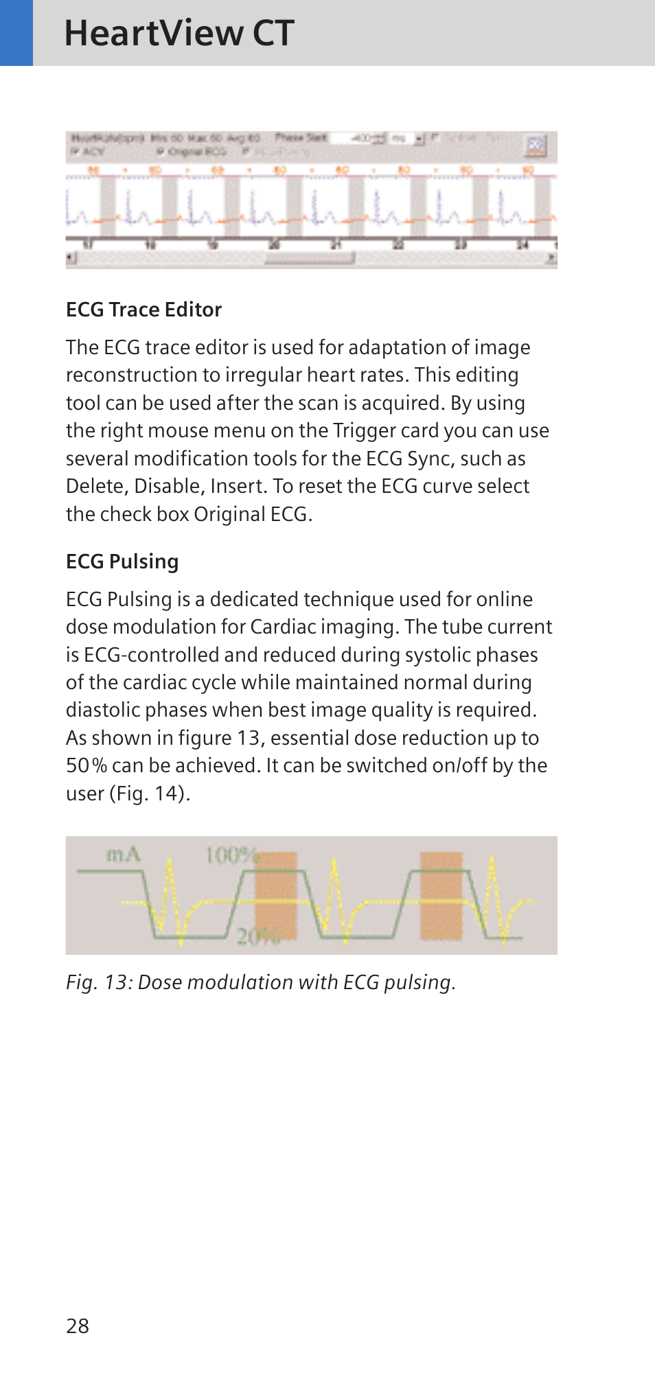 Heartview ct | Siemens SOMATOM SENSATION CARDIAC A60 User Manual | Page 28 / 128