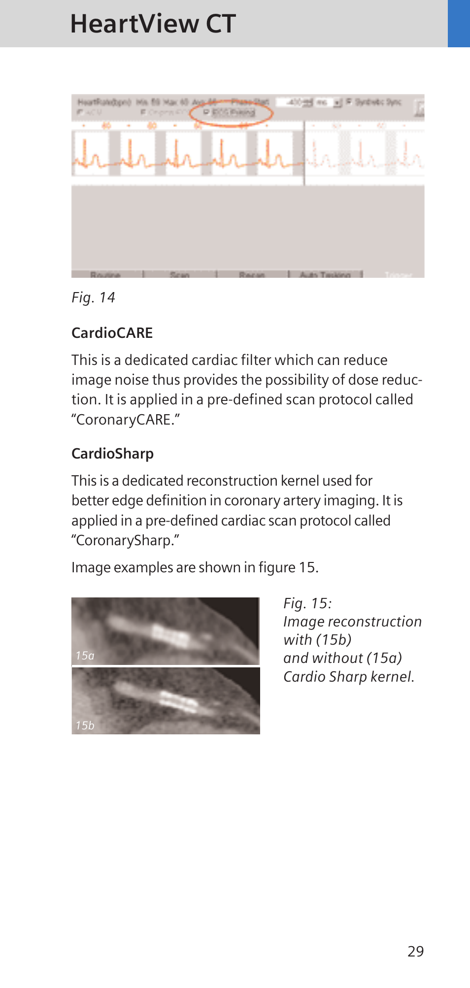 Heartview ct | Siemens SOMATOM SENSATION CARDIAC A60 User Manual | Page 29 / 128