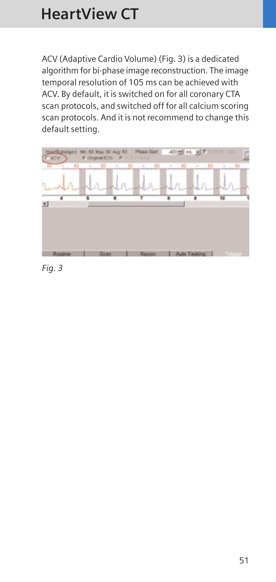 Heartview ct | Siemens SOMATOM SENSATION CARDIAC A60 User Manual | Page 51 / 128
