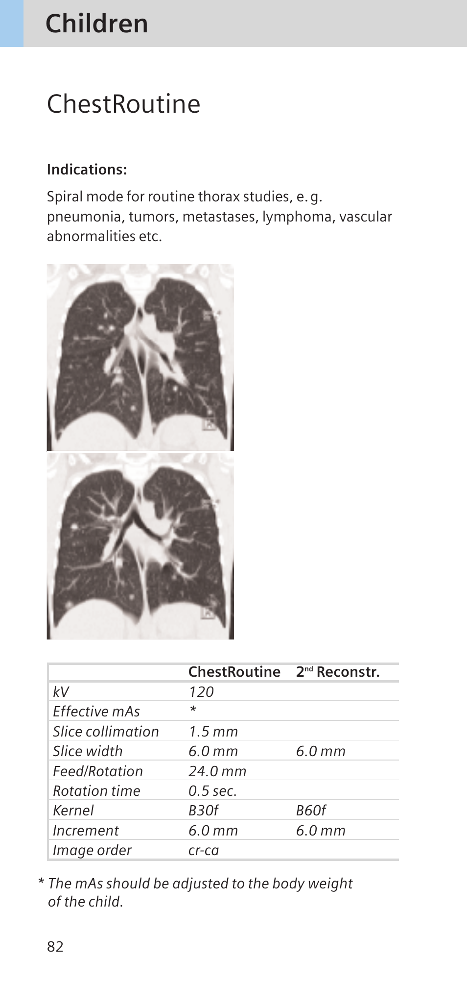 Children chestroutine | Siemens SOMATOM SENSATION CARDIAC A60 User Manual | Page 82 / 128