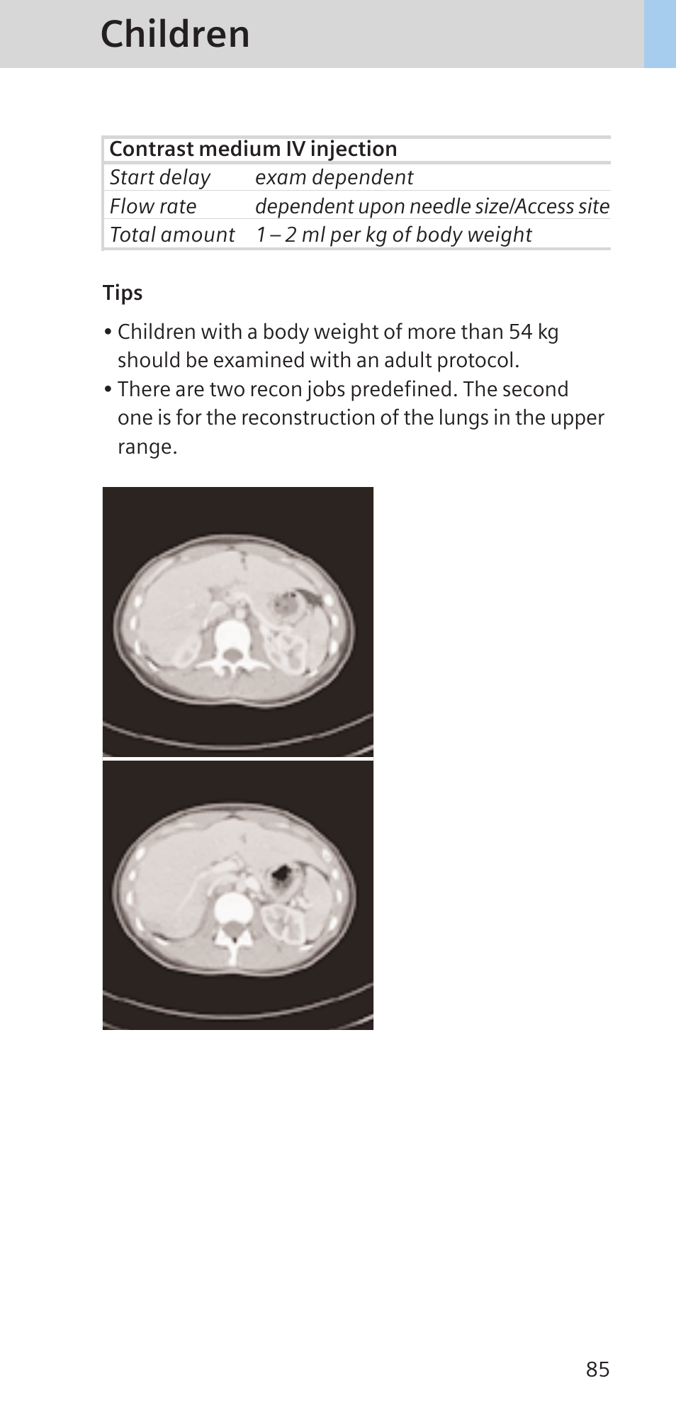 Children | Siemens SOMATOM SENSATION CARDIAC A60 User Manual | Page 85 / 128