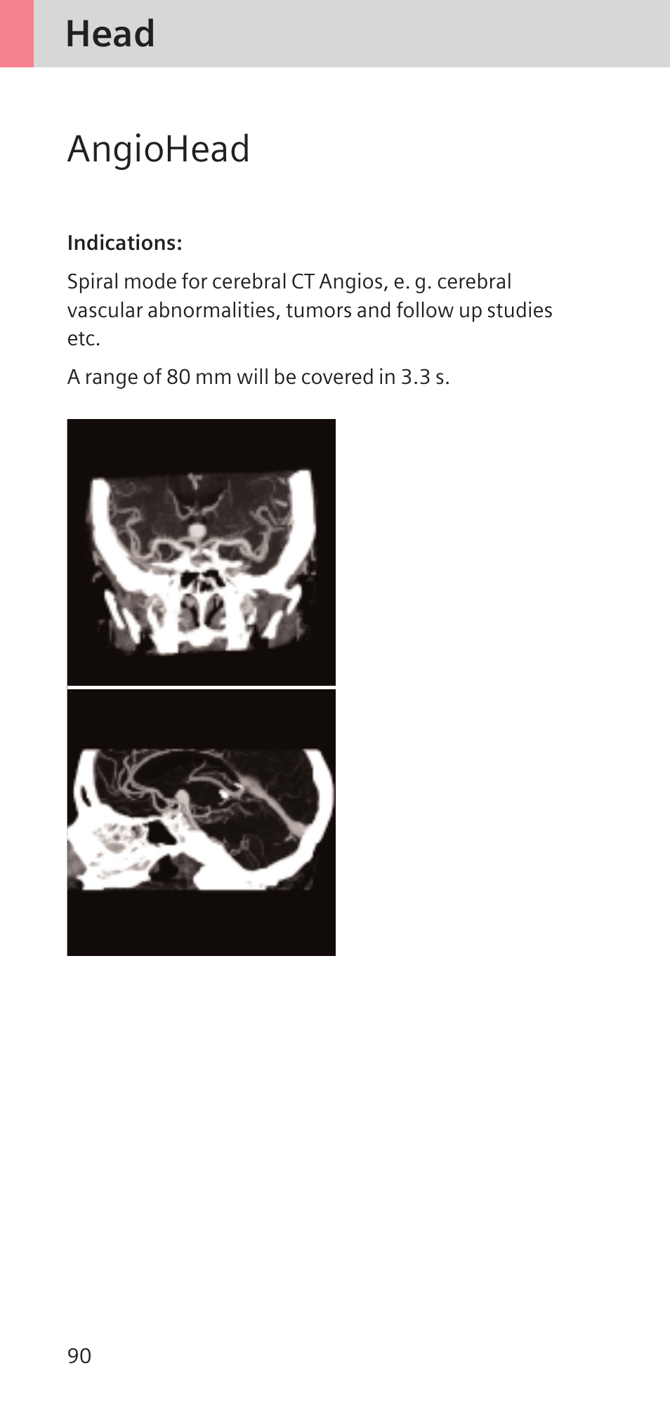 Head angiohead | Siemens SOMATOM SENSATION CARDIAC A60 User Manual | Page 90 / 128