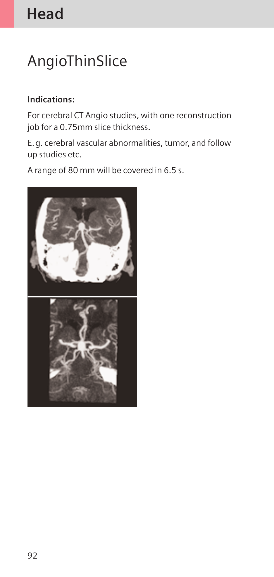 Head angiothinslice | Siemens SOMATOM SENSATION CARDIAC A60 User Manual | Page 92 / 128